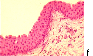 Micrograph F