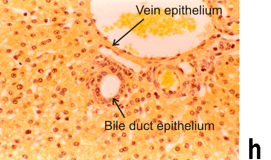 Micrograph H