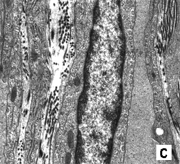 Micrograph C