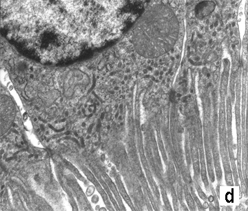 Micrograph D