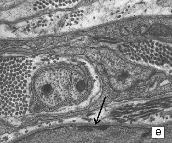 Micrograph E