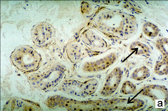 Micrograph A feedback