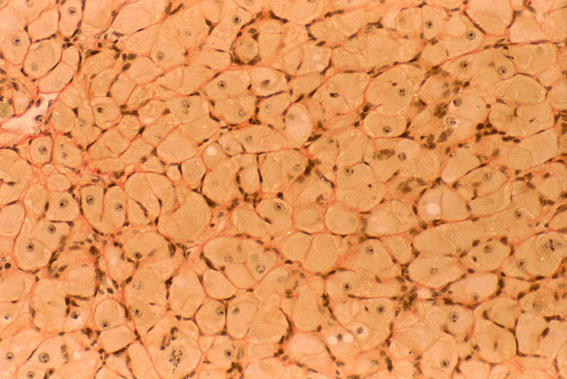 Micrograph B