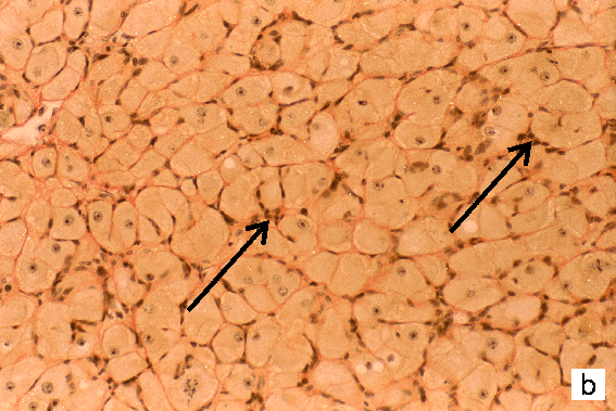 Micrograph B feedback