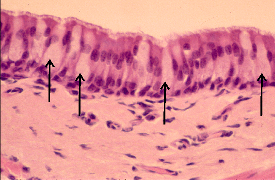 Micrograph E feedback