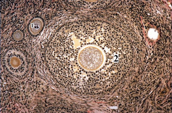 Ovarian Follicles