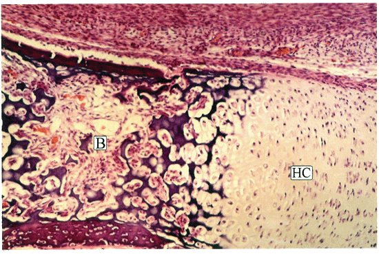 Hyalin Cartilage