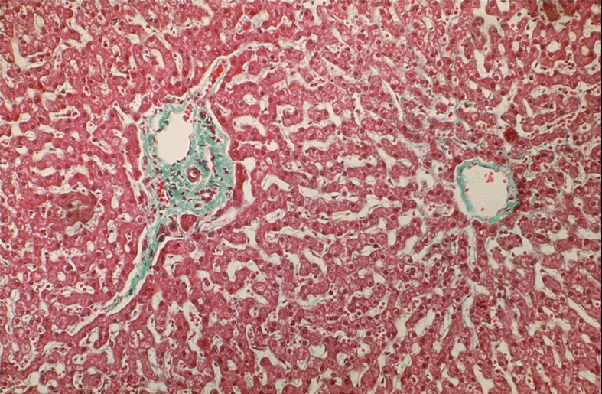 Reticular Connective Tissue