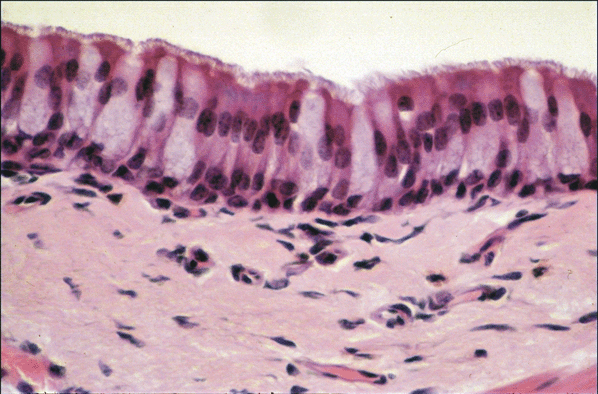 Trachea epithelium