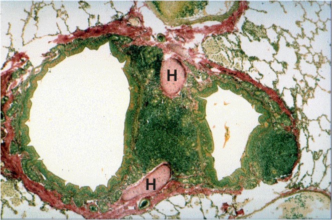 Trachea epithelium