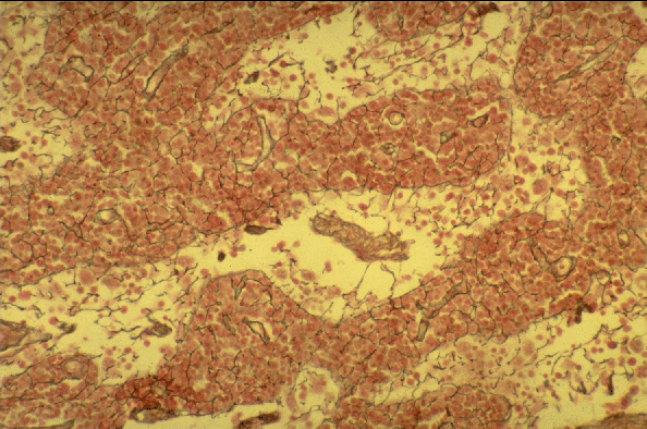 Reticular Connective Tissue