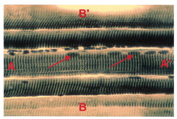 Skeletal Muscle Cells