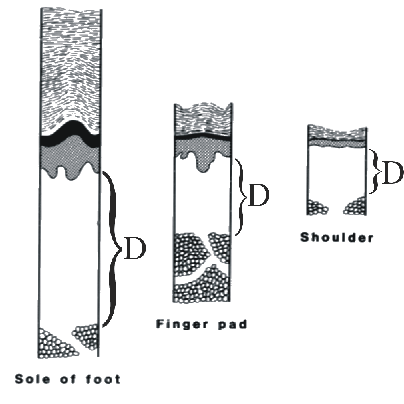 Relative Skin Thickness