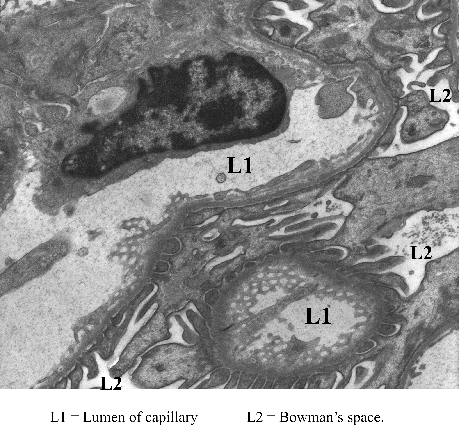 Micrograph of Filtration Barrier