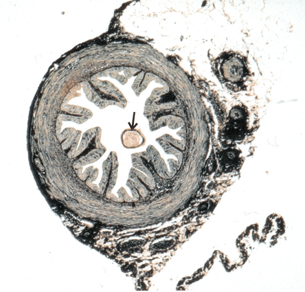 Micrograph of Uterine Tube