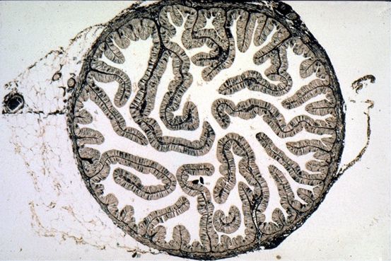 Micrograph of Uterine Tube