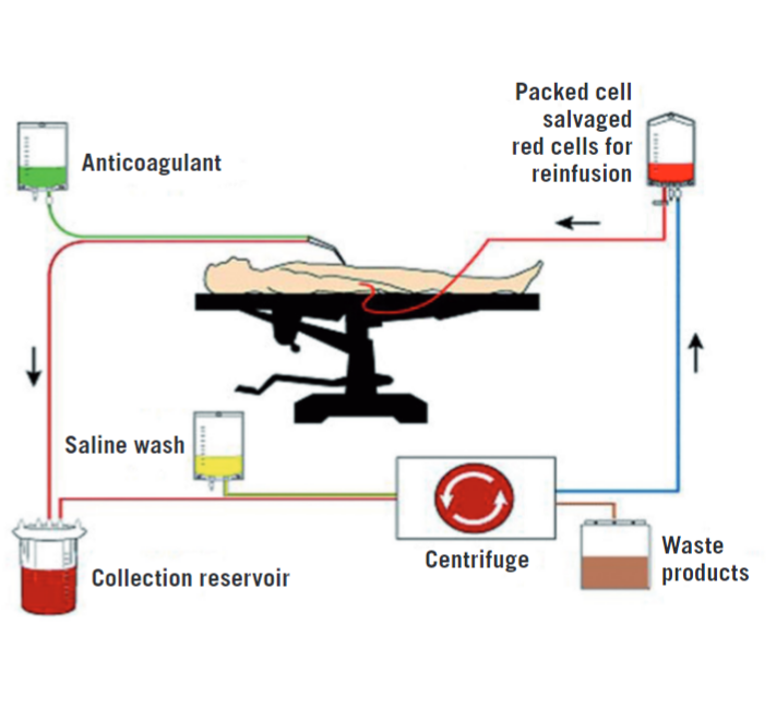 Cell salvage