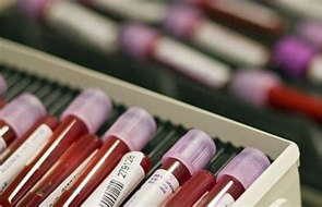 photograph showing blood samples