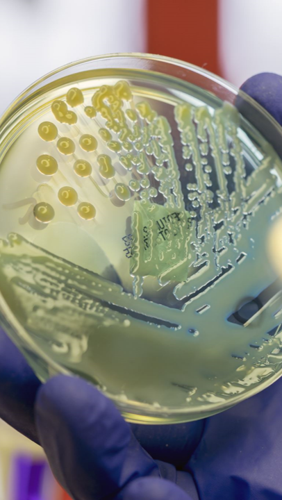 photograph of hand holding a live petri dish