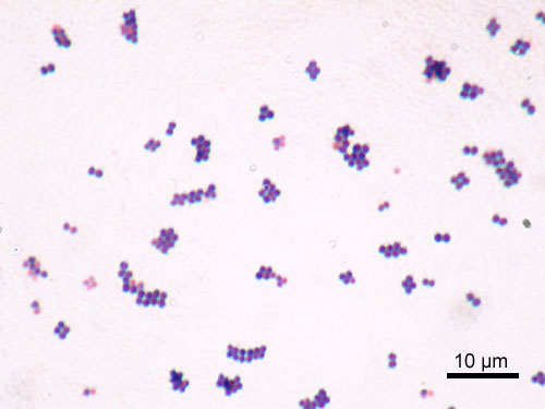 Gram slide of staphylococcus aureus