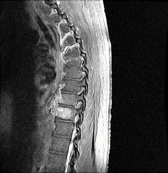 x-ray showing symptoms