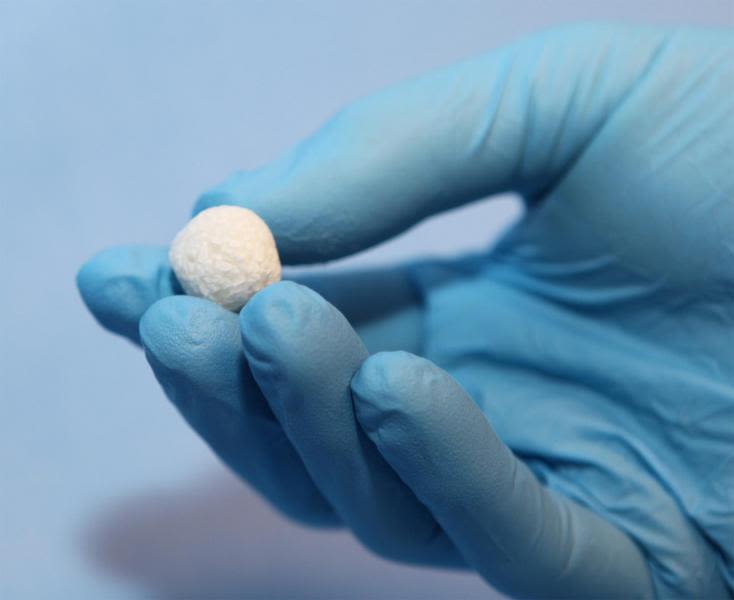 Pioneering New Bone Graft Material To Improve Patient Outcomes